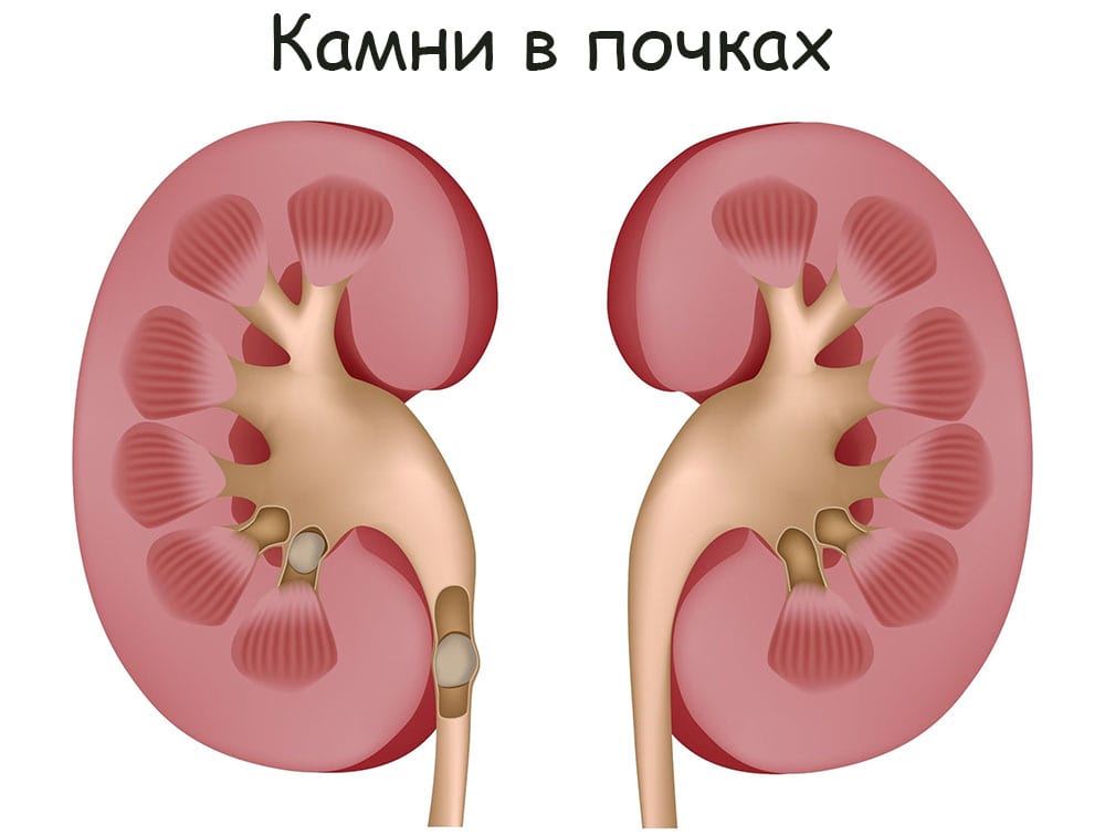 Кракен продажа